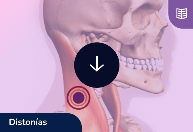 Guía de aplicación distonía 